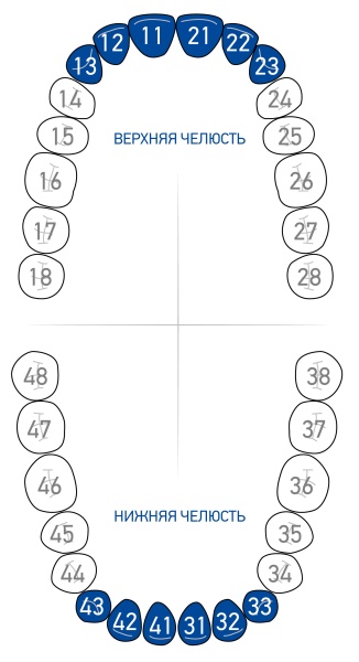 Кламп для коффердама Dentech (Япония) 0